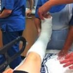 Orthopaedic Plaster Technician: Sponsorship Available