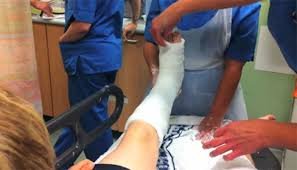 Plaster/Orthopaedic Technician: Sponsorship Available